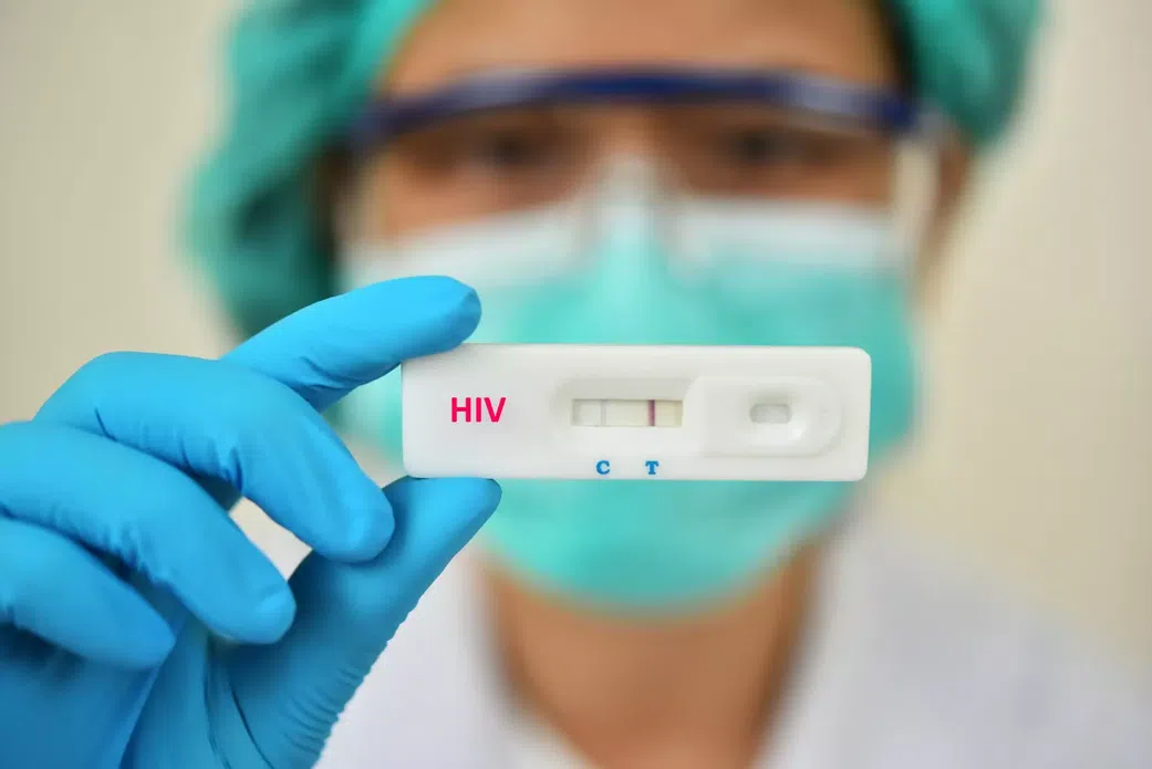 Prévention du VIH : Un espoir inédit pour 2027 à 40 $ par an !