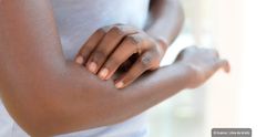 Pourquoi il ne faut pas se gratter en cas d'eczéma de contact