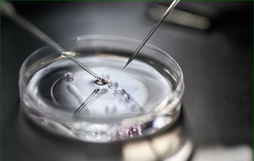The IVF process is a form of assisted reproductive technology (ART) where an egg is fertilised outside the body, typically in a laboratory.