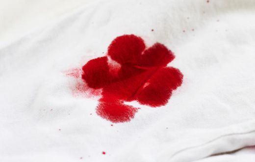 How do you get blood stains off the sheets? [eHow]