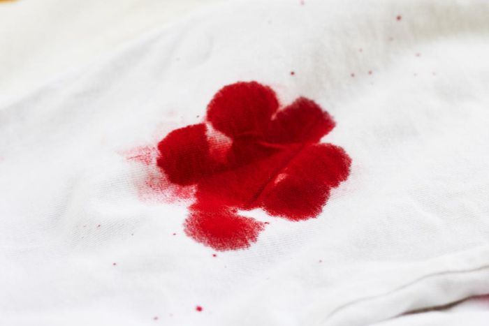 How do you get blood stains off the sheets? [eHow]