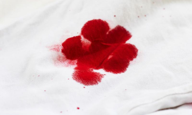 How do you get blood stains off the sheets? [eHow]