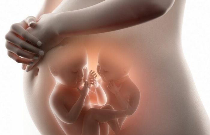 Fraternal twins result from the release of multiple eggs during ovulation [Twinversity]