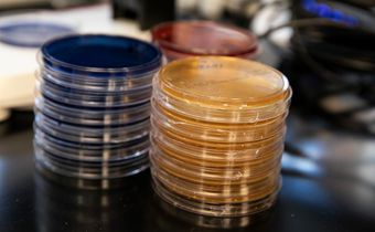 Fecal Donation Tied to Death of a Patient