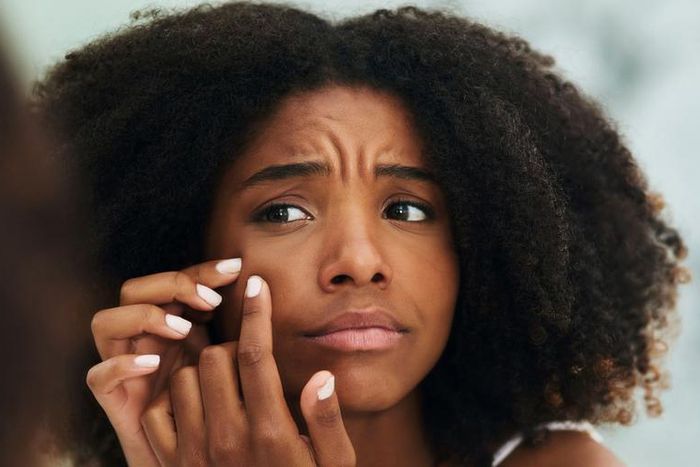 12 Bumps On Your Skin That You Should NEVER Pop