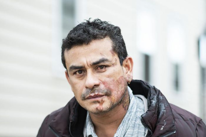 Victim of Milwaukee Acid Attack Says He Was Told to 'Go Back to Your Country'