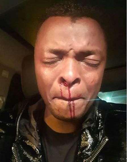 Alichapwa kama Burukenge - Weezdom alleges Ringtone was beaten after gatecrashing party in Runda