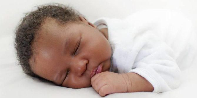 Home remedies for brightening your baby's skin colour