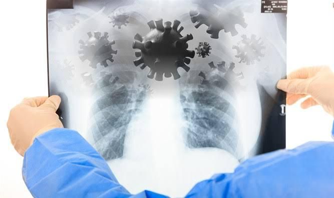 Case of coronavirus reported in Nigeria