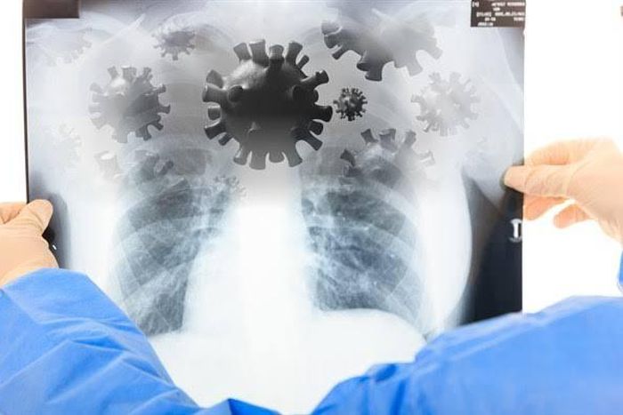 Tests of KHN Patient suspected to have Coronavirus released