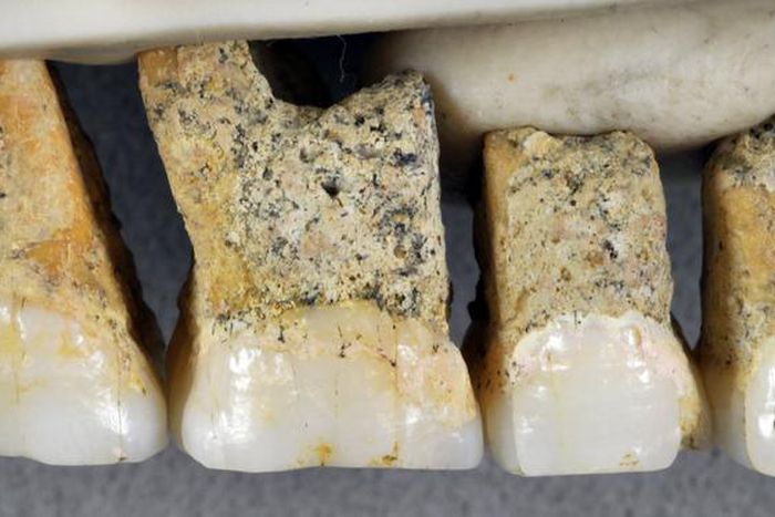 A New Bloom on the Tree of Humanity