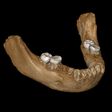 Denisovan Jawbone Discovered in a Cave in Tibet