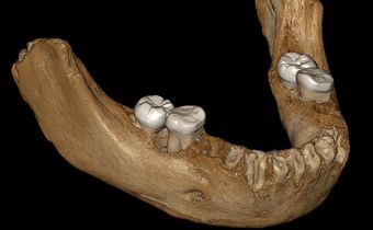 Denisovan Jawbone Discovered in a Cave in Tibet