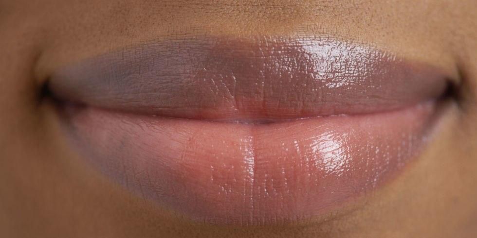 Dark lips can also be triggered by skin disorders, chemical and other lifestyle factors