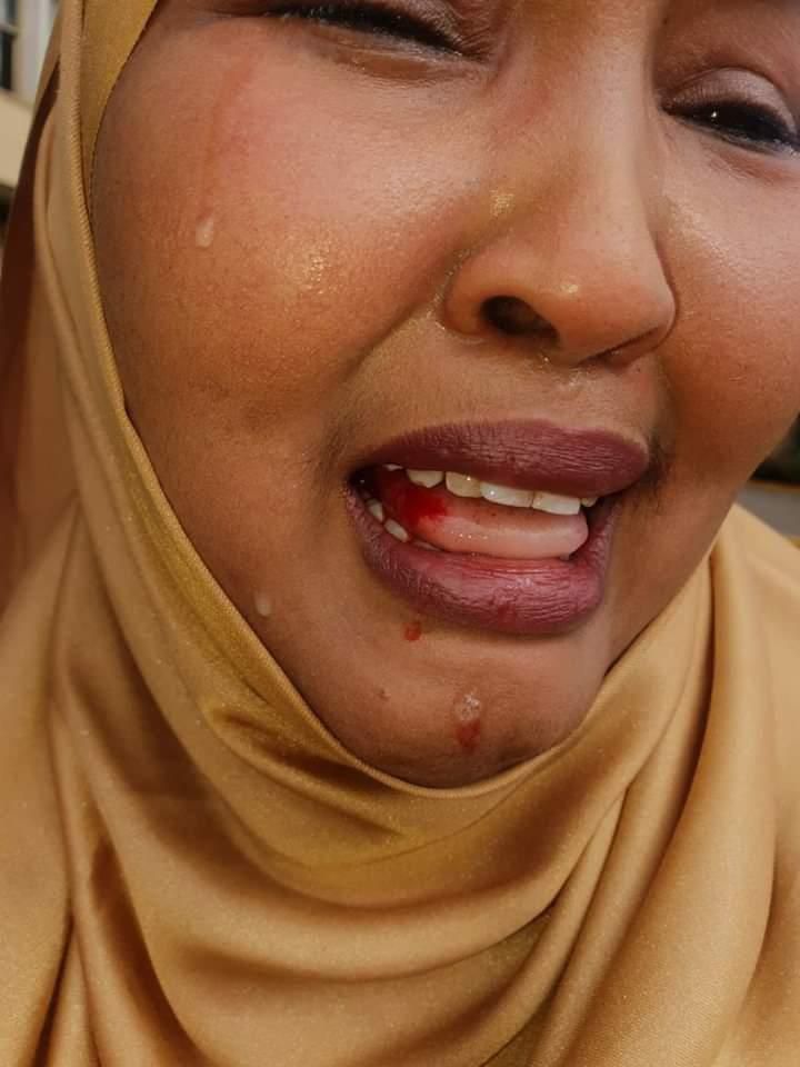 Wajir Woman Rep Fatuma Gedi badly beaten up Wajir East MP Rashid Kassim at Parliament buildings