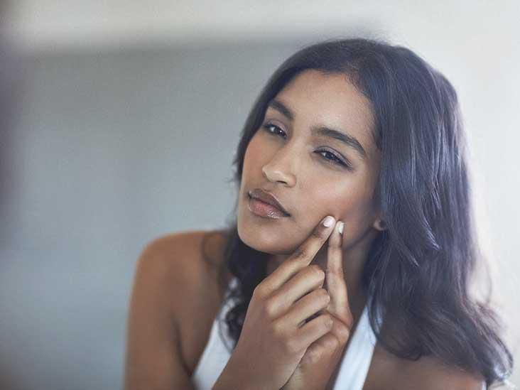 ___8102796___2018___3___12___13___732x549_Types_of_Acne_1