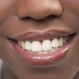 5 natural ways to make your teeth white and shiny