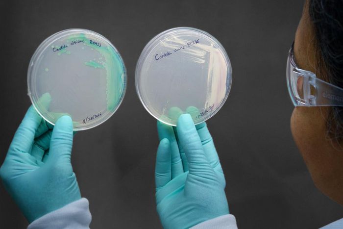 How a Chicago Woman Fell Victim to Candida Auris, a Drug-Resistant Fungus