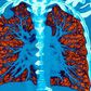 AI took a test to detect lung cancer, it got an A
