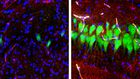 Study Opens Up a Gap Between Life and Death