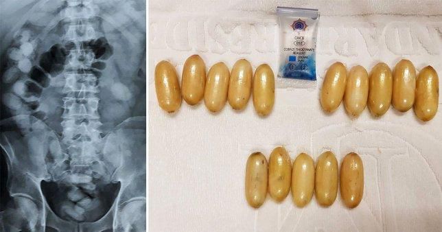 Police say the suspect swallowed 68 capsules of cocaine