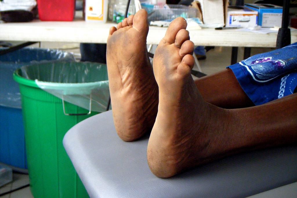 Rough feet(Gini in Africa)
