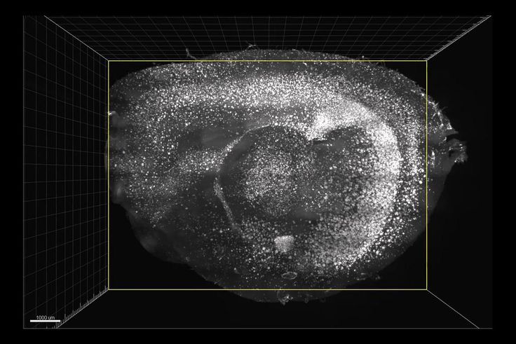 Flashing Lights and Sounds Improve Memory and Learning Skills in Mice