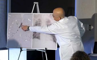 Facing 'Certain Death,' Boy With Vaping Injury Gets Double Lung Transplant