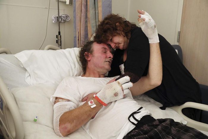 Wildfire Burn Victims 'Live That Nightmare Every Day'