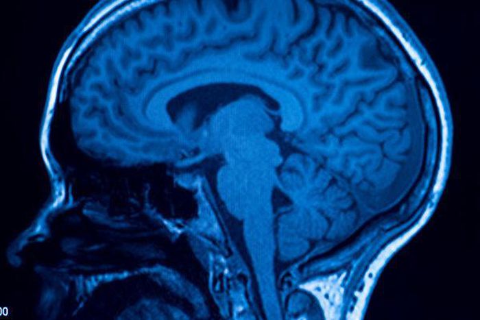 How eyewitness memories can be shaped by the brain's response to trauma