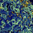 As word of a second HIV cure spreads, patients wonder: What now?
