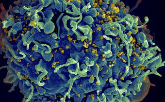 As word of a second HIV cure spreads, patients wonder: What now?