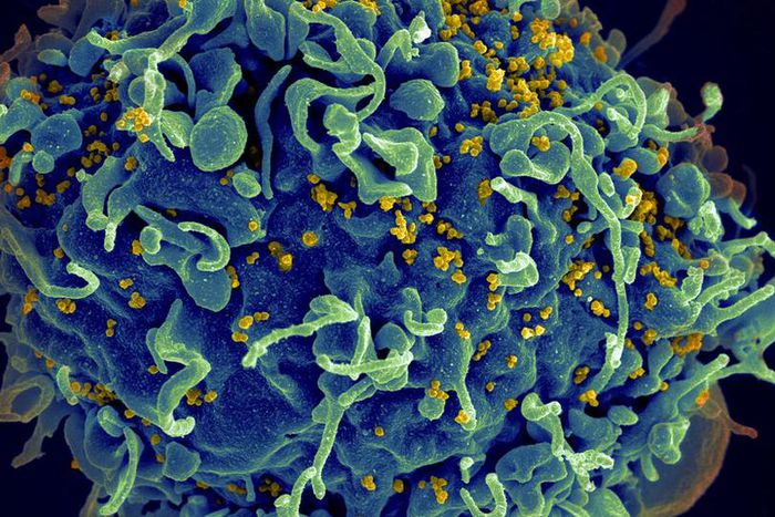 As word of a second HIV cure spreads, patients wonder: What now?