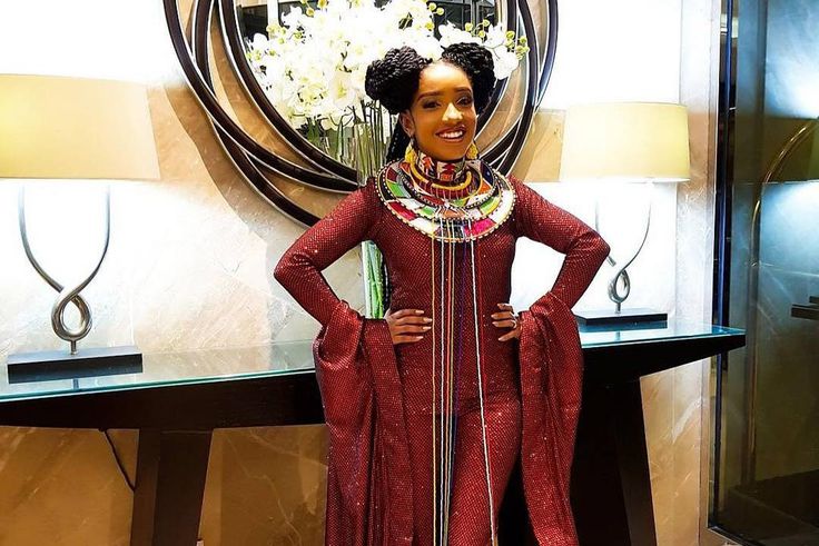 I suffer from seizures – Anita Nderu says as she explains the scar on her right hand