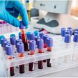 Blood samples in a test tube