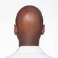 What makes men go bald in their 20s [istockphoto]
