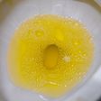 Why your urine is yellow [Adobestock]