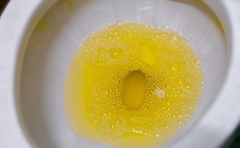 Why your urine is yellow [Adobestock]