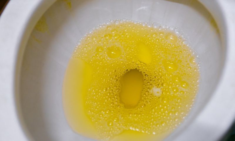 Why your urine is yellow [Adobestock]
