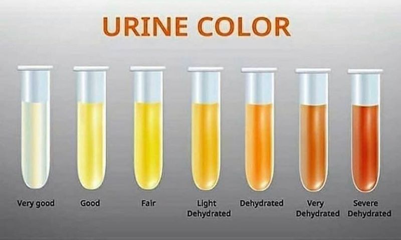 Why does your urine change colour? [Xcom]
