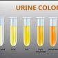 Why does your urine change colour? [Xcom]