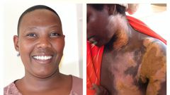 Doreen Atwongeirwe, a lectuerer at BSU is accused of scalding her housemaid Anita Kansiime