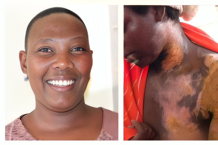 Doreen Atwongeirwe, a lectuerer at BSU is accused of scalding her housemaid Anita Kansiime