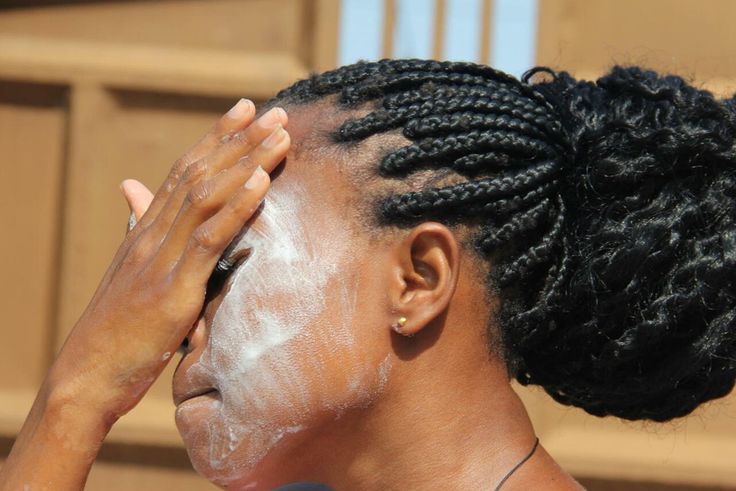Can bleaching creams cause blindness [RFI]