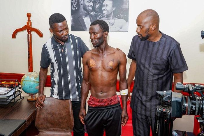 Eric-Mwesigwa-NUP-Torture