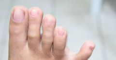 Able to separate little toe