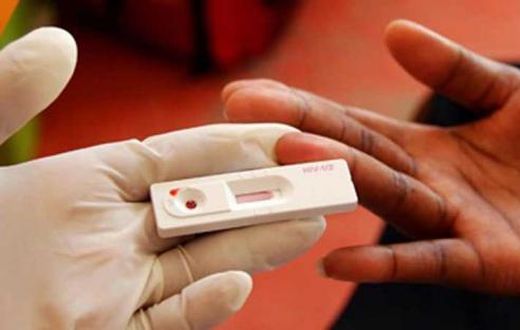 A HIV test kit