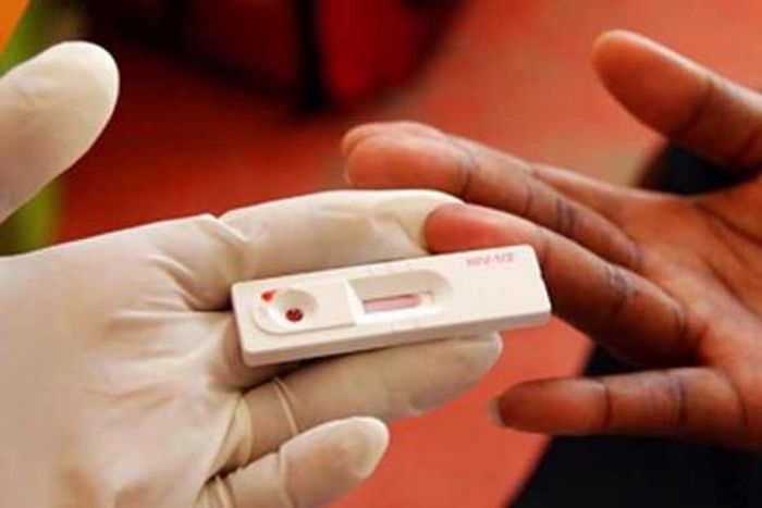 A HIV test kit