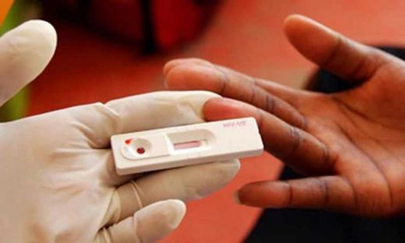 A HIV test kit