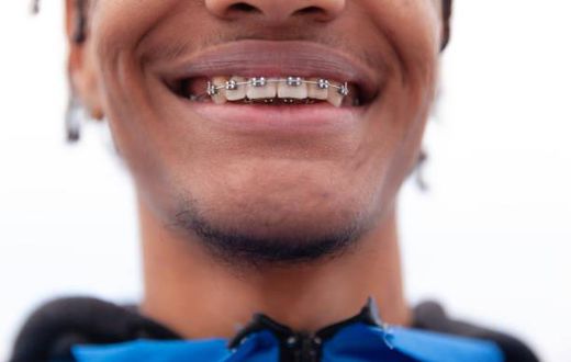 A person with braces